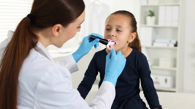 Nhận biết hình ảnh viêm họng mủ ở trẻ em 3
