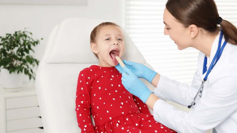 Nhận biết hình ảnh viêm họng mủ ở trẻ em 1