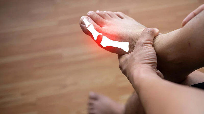Cơn đau bệnh gout có thể lan sang các khớp khác