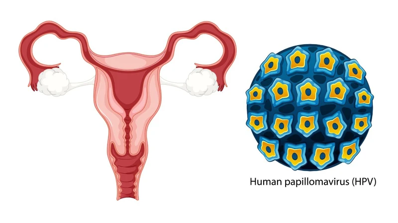 Nhiễm HPV 18 có chữa được không? 1