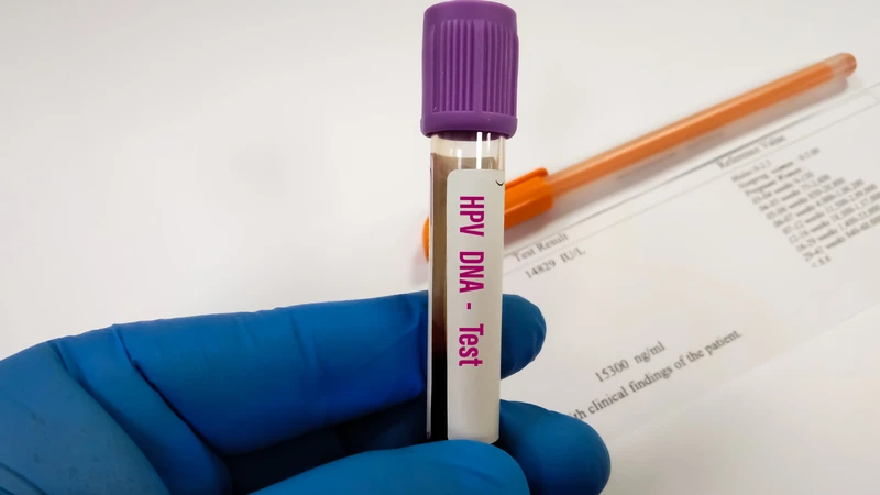 Việc hiểu rõ về kết quả xét nghiệm HPV giúp phụ nữ chủ động hơn trong việc chăm sóc sức khỏe sinh sản