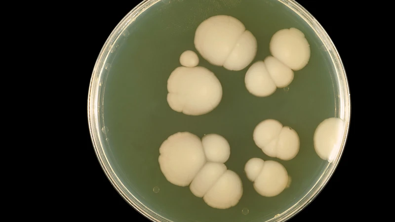 Nhiễm nấm candida ở phổi là gì? Bệnh nguy hiểm như thế nào? 5.png
