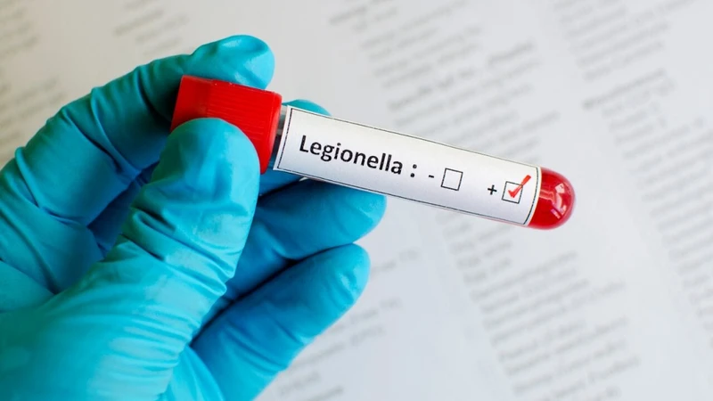 Nhiễm trùng Legionella là gì? Triệu chứng và cách phòng ngừa 4