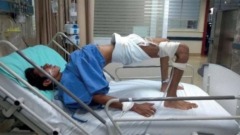 Nhiễm trùng uốn ván​: Triệu chứng và biện pháp phòng ngừa
