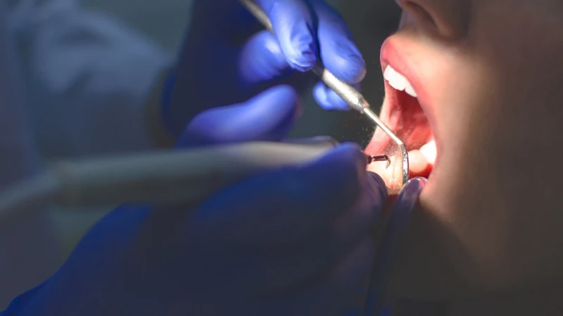 Sau nhổ răng, tuyệt đối không tự quyết định dựa trên thông tin từ các nguồn không có căn cứ y khoa