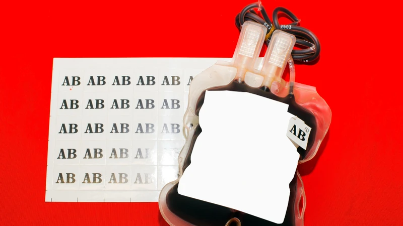 Nhóm máu AB nhìn chung ít gặp nhất trong hệ ABO, nhận thức đúng về thông tin nhóm máu giúp giảm rủi ro trong các tình huống khẩn cấp