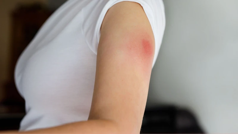 Vị trí tiêm có thể bị đỏ hoặc sưng nhẹ