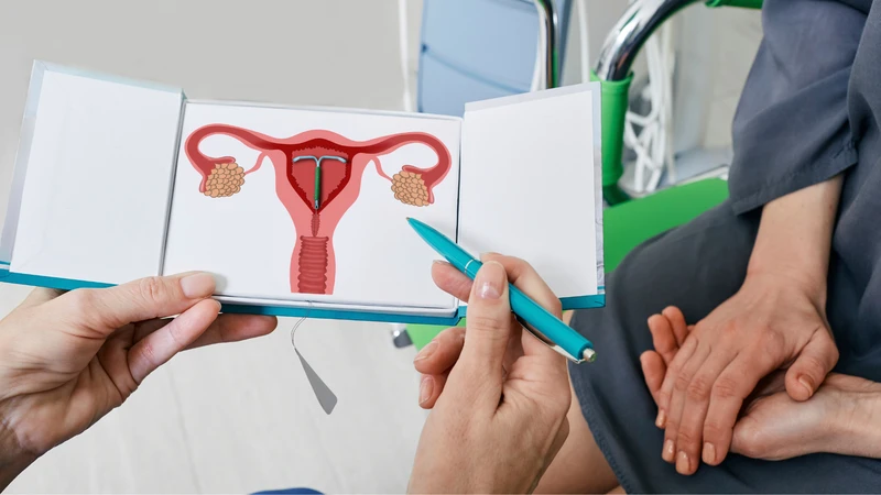Những dấu hiệu đa nang buồng trứng chị em cần lưu ý 4