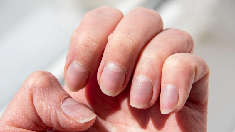 Hình dạng móng tay thay đổi, bề mặt không nhẵn có thể liên quan đến chức năng gan suy giảm