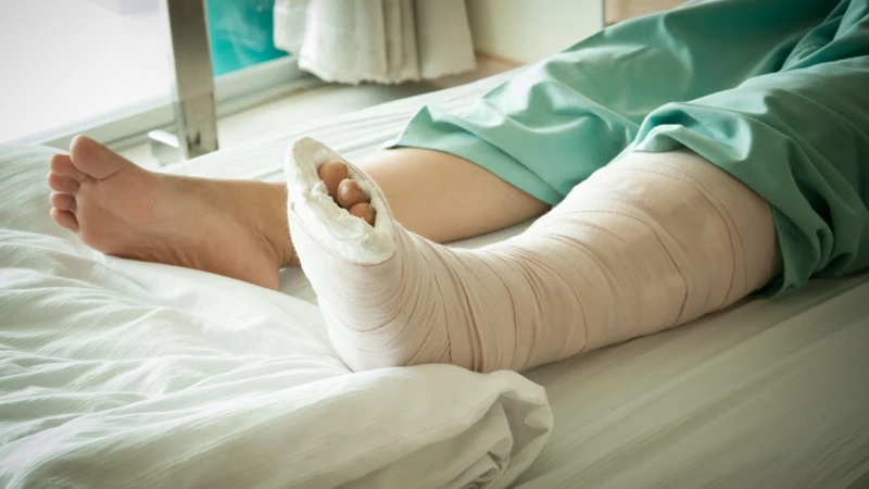 Gãy xương bệnh lý là một dấu hiệu ung thư xương chân
