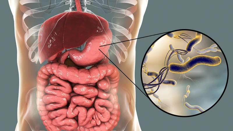 Những điều nên biết trước khi nội soi dạ dày 2