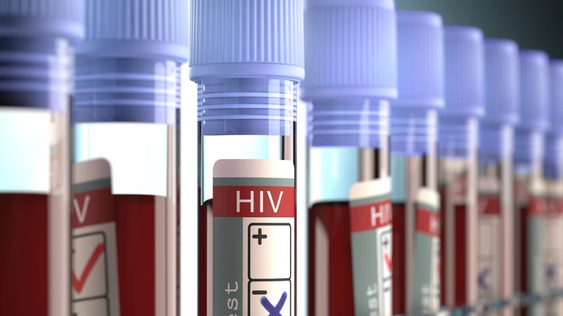 Những thông tin quan trọng cần biết về xét nghiệm HIV 2
