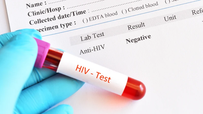 Những thông tin quan trọng cần biết về xét nghiệm HIV 4