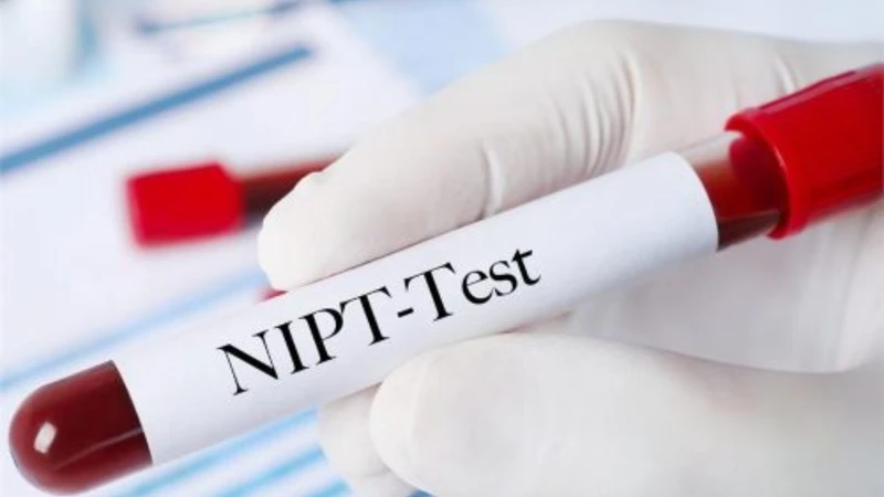 NIPT 3 là xét nghiệm sàng lọc trước sinh không xâm lấn, sử dụng mẫu máu của mẹ để phân tích ADN tự do của thai nhi lưu hành trong máu