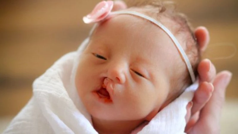 NIPT 3 không thay thế hoàn toàn siêu âm hình thái học, không có khả năng phát hiện tất cả các dị tật bẩm sinh
