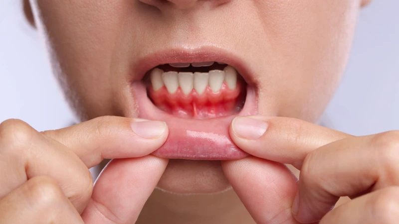 Khối cứng trên lợi có thể xuất hiện với kích thước và vị trí khác nhau ở mỗi người