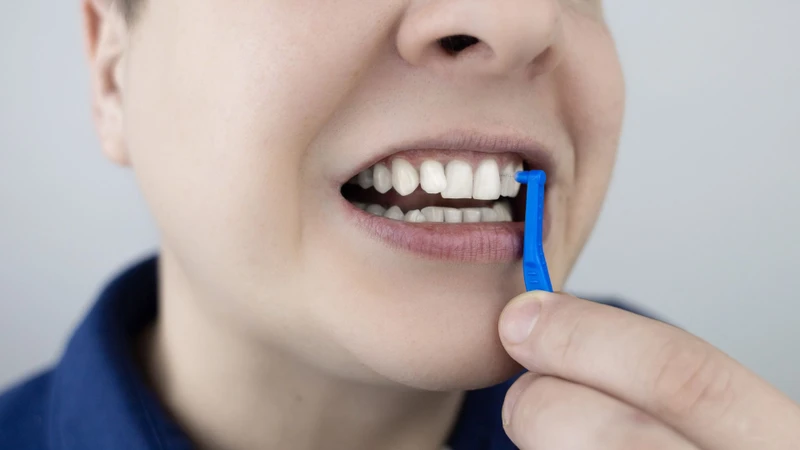 Tình trạng viêm nổi cục cứng ở lợi có thể liên quan đến mảng bám và vệ sinh răng miệng chưa đúng cách