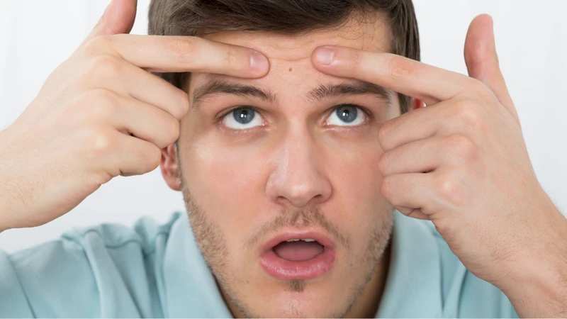 Nổi gân trên trán là bệnh gì? Tình trạng này có thể liên quan đến yếu tố sinh lý hoặc một số vấn đề sức khỏe