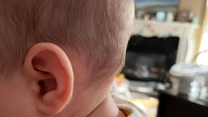 Nổi hạch sau đầu ở trẻ em là gì? Nguyên nhân và cách điều trị 5