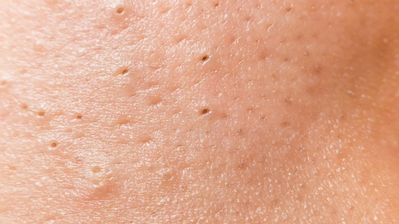 Giữ vùng da mông sạch và khô thoáng