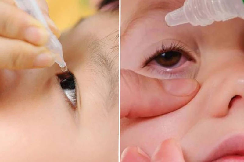 Nước mắt nhân tạo cho trẻ em nên dùng khi nào? Những lưu ý cần biết 2