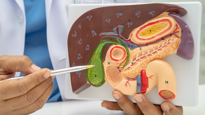 Nút mạch gan là gì? Phương pháp điều trị hiệu quả cho bệnh lý gan bạn nên biết3