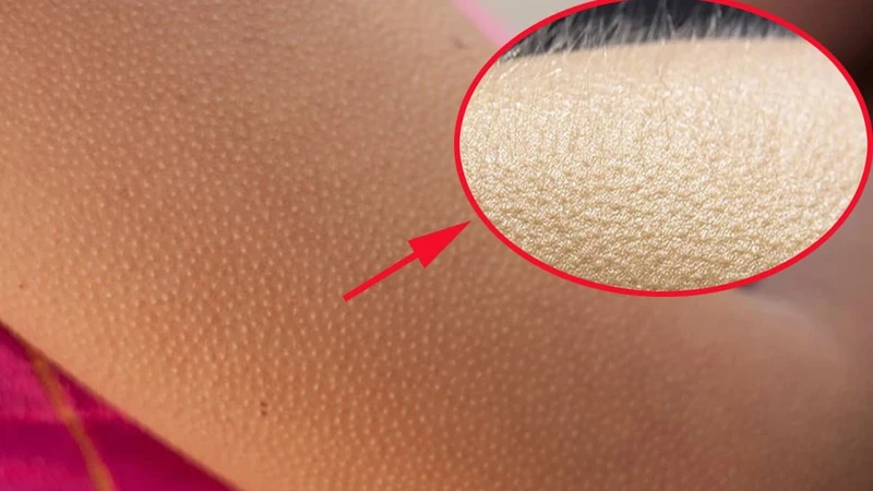 Ớn lạnh trong người là gì? Tại sao bạn lại mắc bệnh? 1.jpg