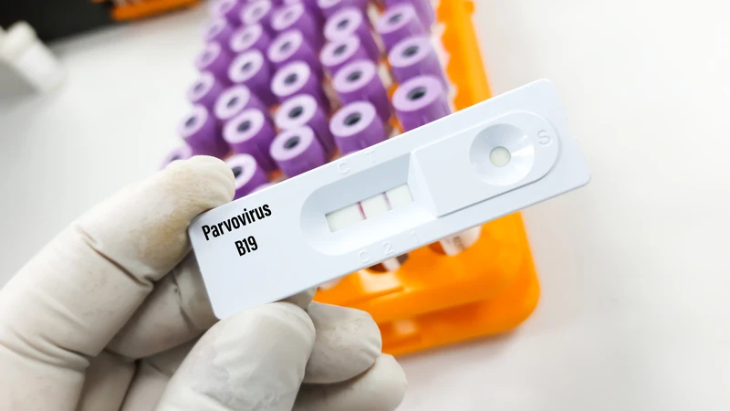 Parvovirus b19 là gì và gây bệnh như thế nào?
