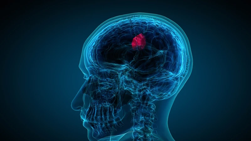 Phác đồ điều trị sarcoma được cá thể hóa dựa trên loại khối u, giai đoạn bệnh và tình trạng sức khỏe
