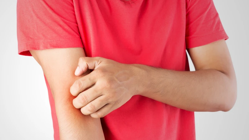 Phân biệt dấu hiệu sốt phát ban và tay chân miệng 4