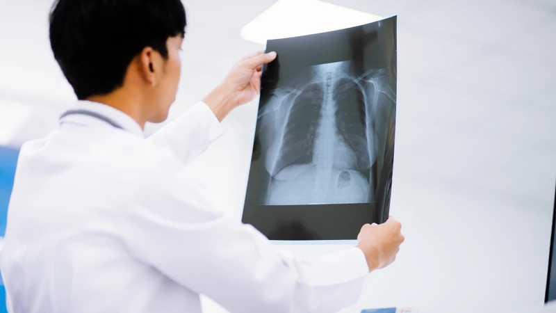 Phân độ suy hô hấp là gì? Tiêu chí phân độ suy hô hấp theo lâm sàng và cận lâm sàng 3