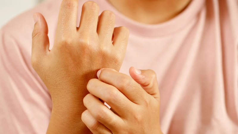 Phản ứng quá mẫn là gì? Hiểu đúng để xử lý kịp thời 3