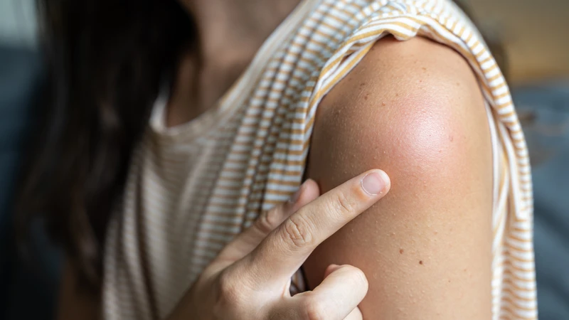 Phản ứng sau tiêm phòng dại: Những điều cần biết để bảo vệ sức khỏe 1