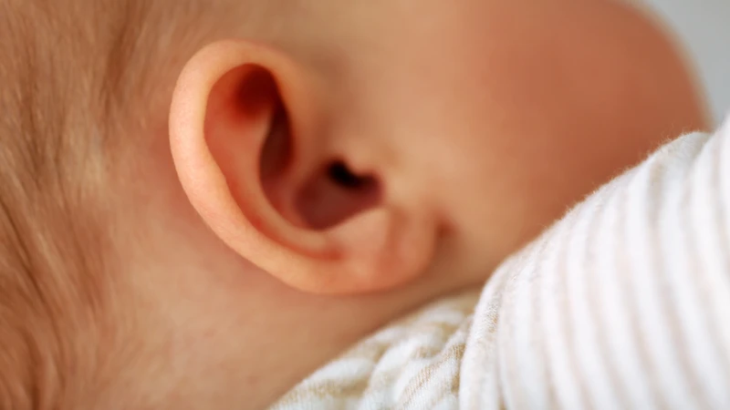 Tai vểnh là tình trạng vành tai nhô ra khỏi đầu nhiều hơn bình thường