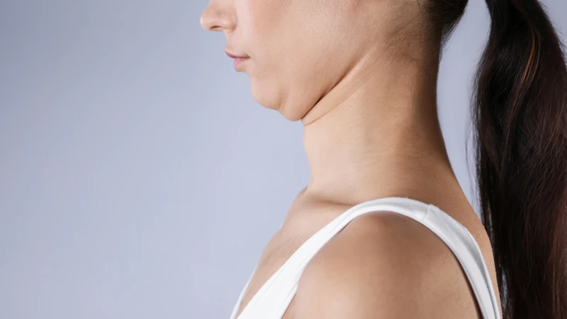 Nhiều người thắc mắc phẫu thuật trượt cằm là gì?