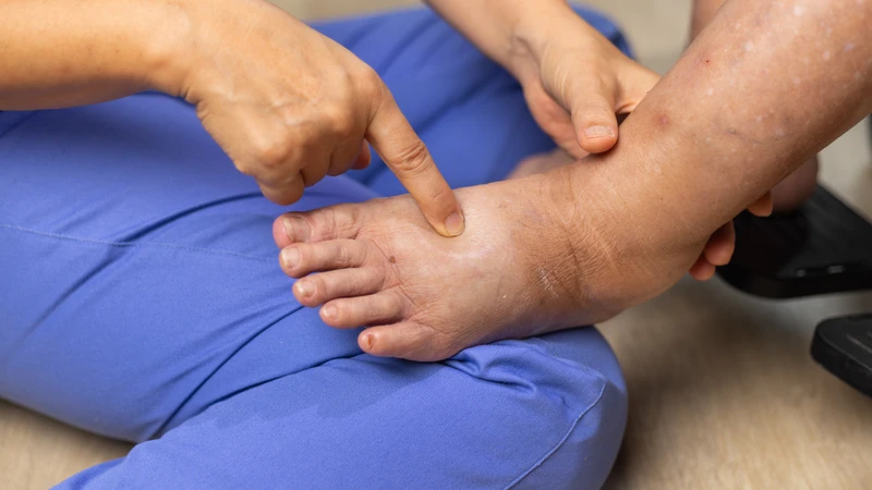 Phù nề sau phẫu thuật bao lâu thì hết tùy mức độ can thiệp