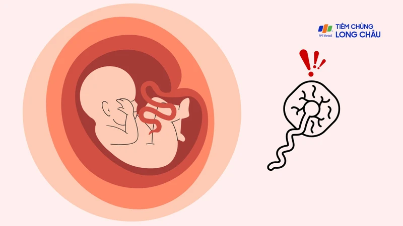 "Phù nhau thai có nguy hiểm không?" là thắc mắc của nhiều mẹ bầu