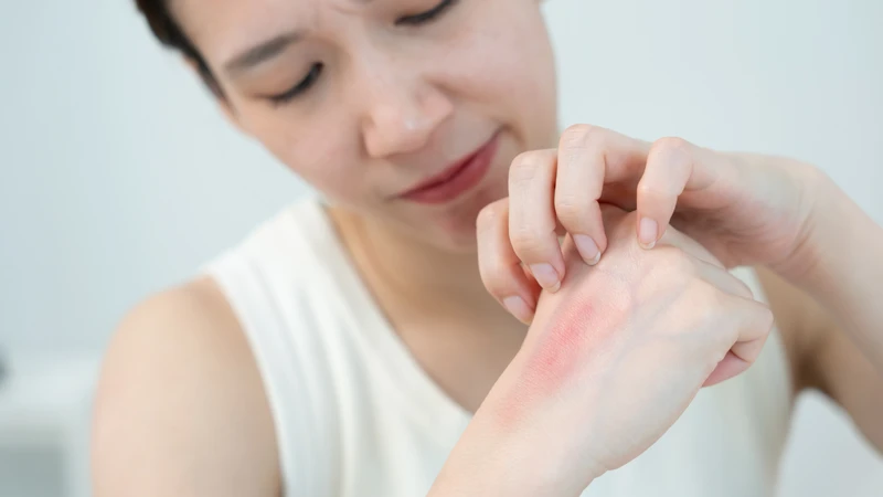 Các hóa chất trong thuốc diệt muỗi không chuyên dụng có thể gây ra tình trạng nổi mẩn ngứa, đỏ da