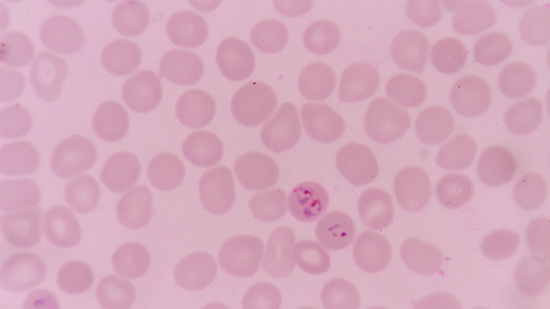 Plasmodium falciparum là loài ký sinh trùng gây bệnh sốt rét ở người