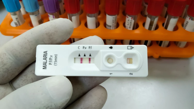 Bác sĩ có thể chỉ định xét nghiệm lại nếu vẫn nghi ngờ nhiễm sốt rét