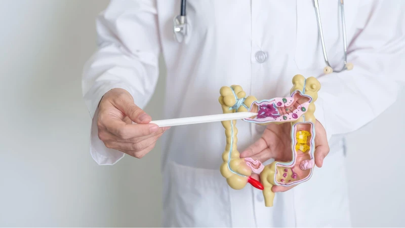 Peutz-Jeghers có thể gây polyp đường tiêu hóa