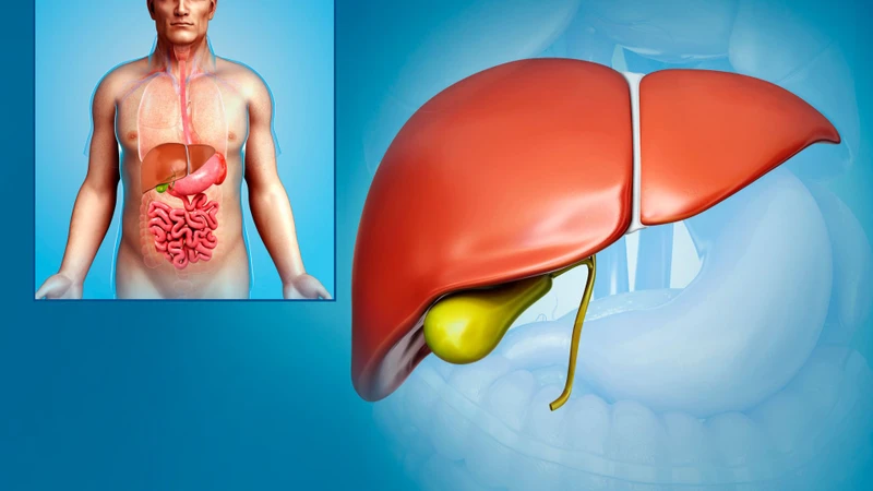 Polyp túi mật 6mm có nguy hiểm không là câu hỏi khiến nhiều người lo lắng