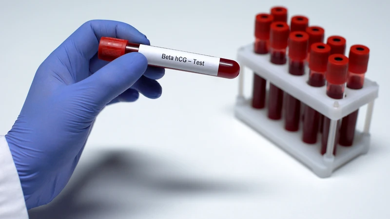 Hormone hCG chỉ có thể được phát hiện trong máu khoảng 2 - 3 ngày sau khi làm tổ và trong nước tiểu vài ngày sau đó