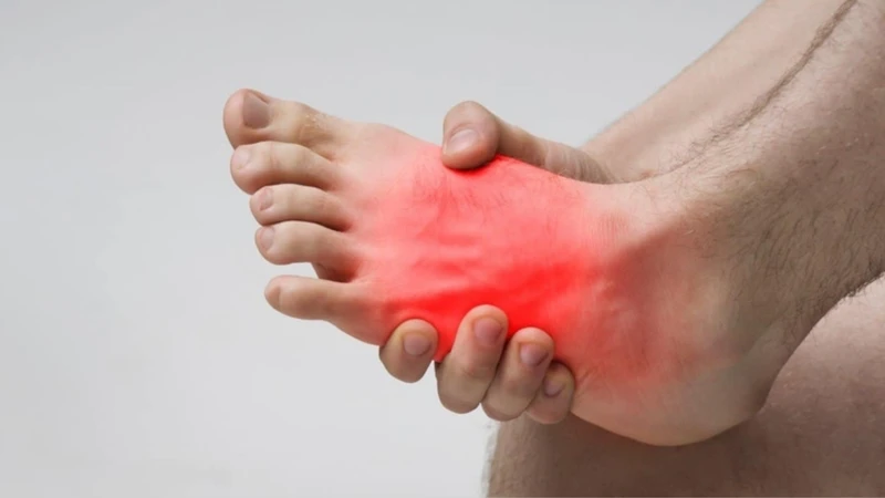 Sưng đỏ vùng bàn chân là triệu chứng xuất hiện ngay sau khi bị chấn thương