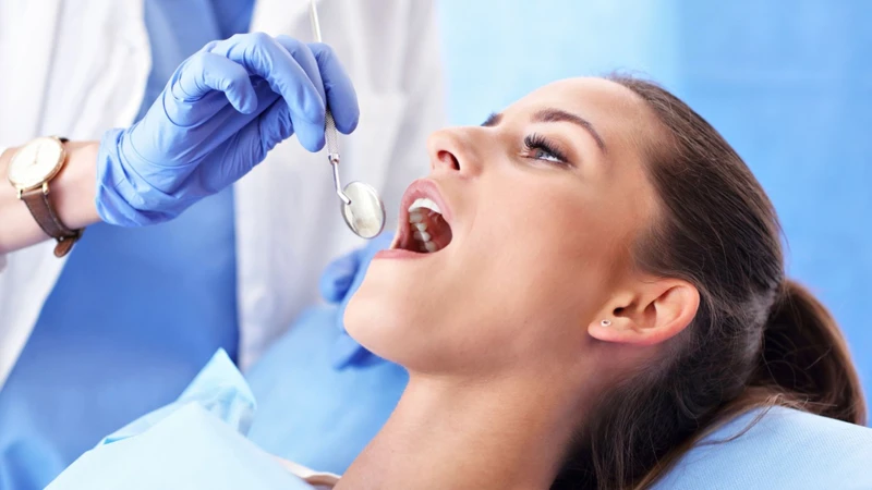 Việc trám răng khôn thường không được khuyến khích do nguy cơ sâu tái phát khá cao