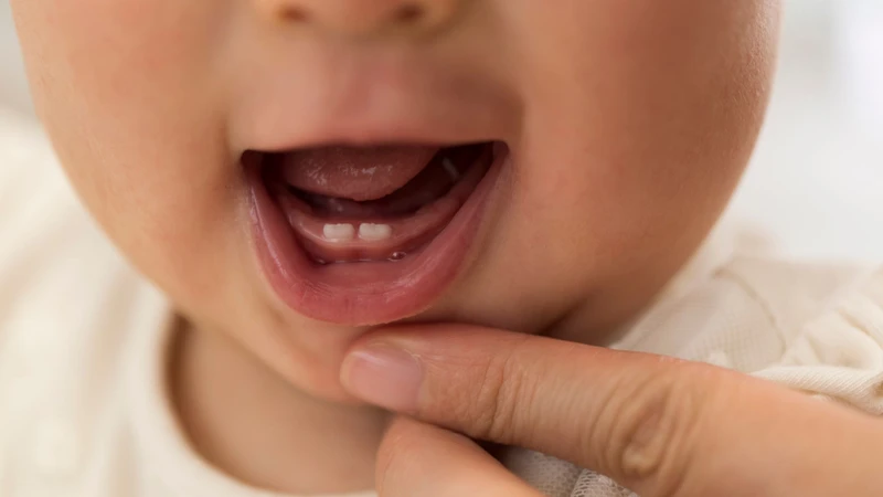 Răng sữa của trẻ là gì? Những điều cha mẹ cần biết 3