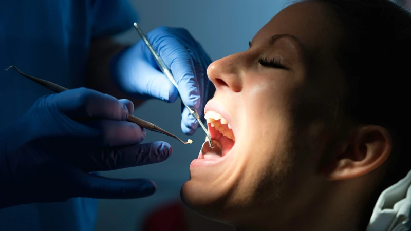Răng trám rồi có trám lại được không? Vẫn có thể, khi phần mô răng còn đủ khỏe và chưa hư hại nặng