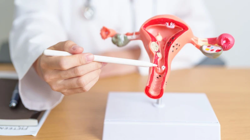U xơ tử cung cũng có liên quan đến sự rối loạn kinh nguyệt ở giai đoạn tiền mãn kinh