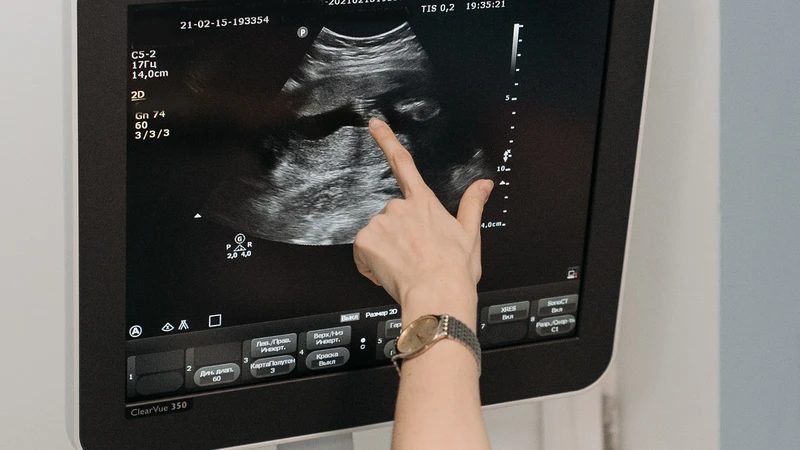 Ngôi thai bất thường, đa ối hoặc sinh non có thể làm tăng nguy cơ sa dây rốn trong thai kỳ