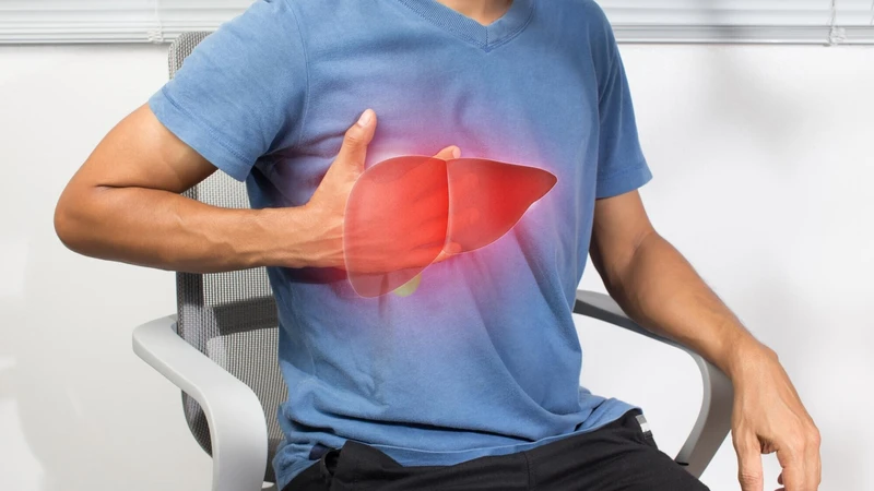 Sẩn ngứa do gan là tình trạng da nổi mẩn và ngứa dai dẳng xảy ra khi chức năng gan bị suy giảm